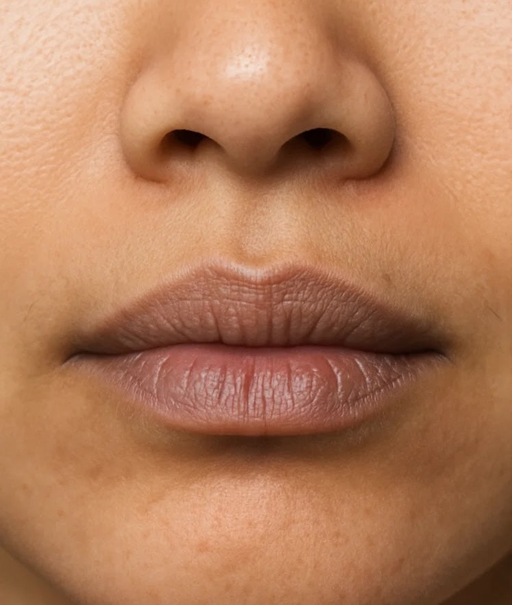 lip discolouration - genetics