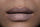 What causes lip pigmentation? - Tenol™