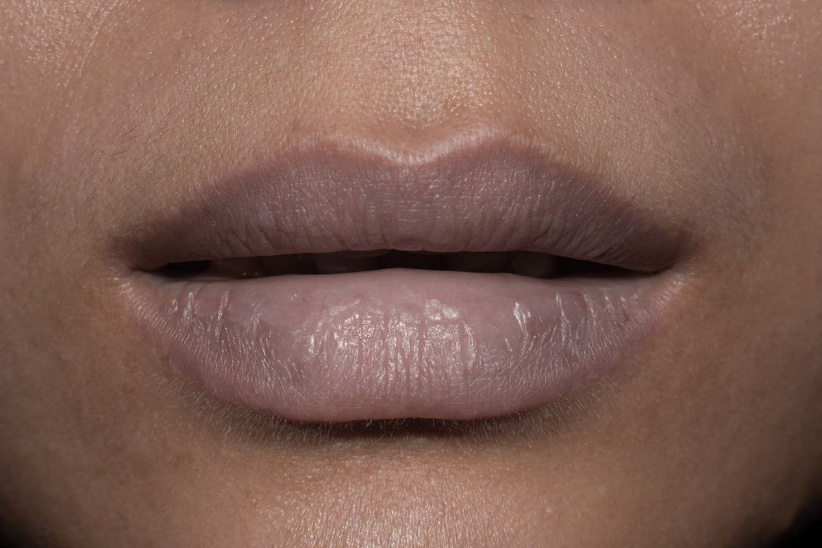 What Causes Lip Hyperpigmentation? – TenolCare