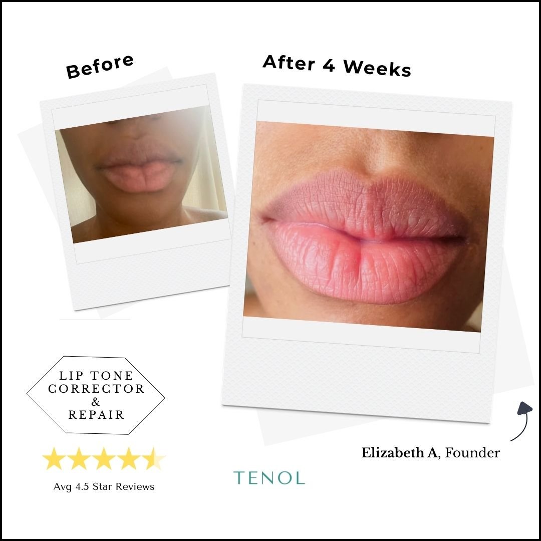 Two - Step Intensive Resurfacing & Correction Lip System - Tenol™ - 