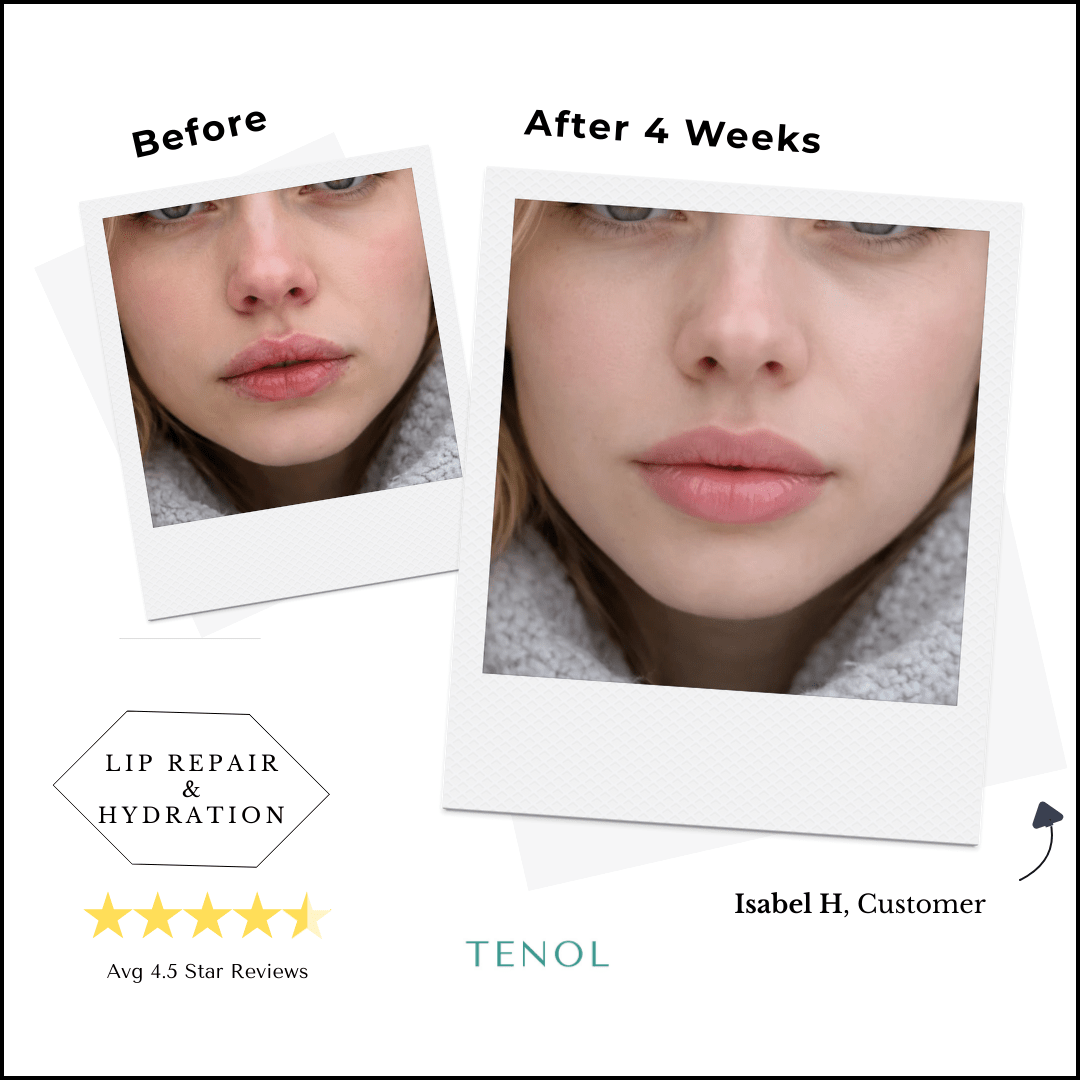 Two - Step Exfoliant & Hydration Lip Treatment - Tenol™ - 