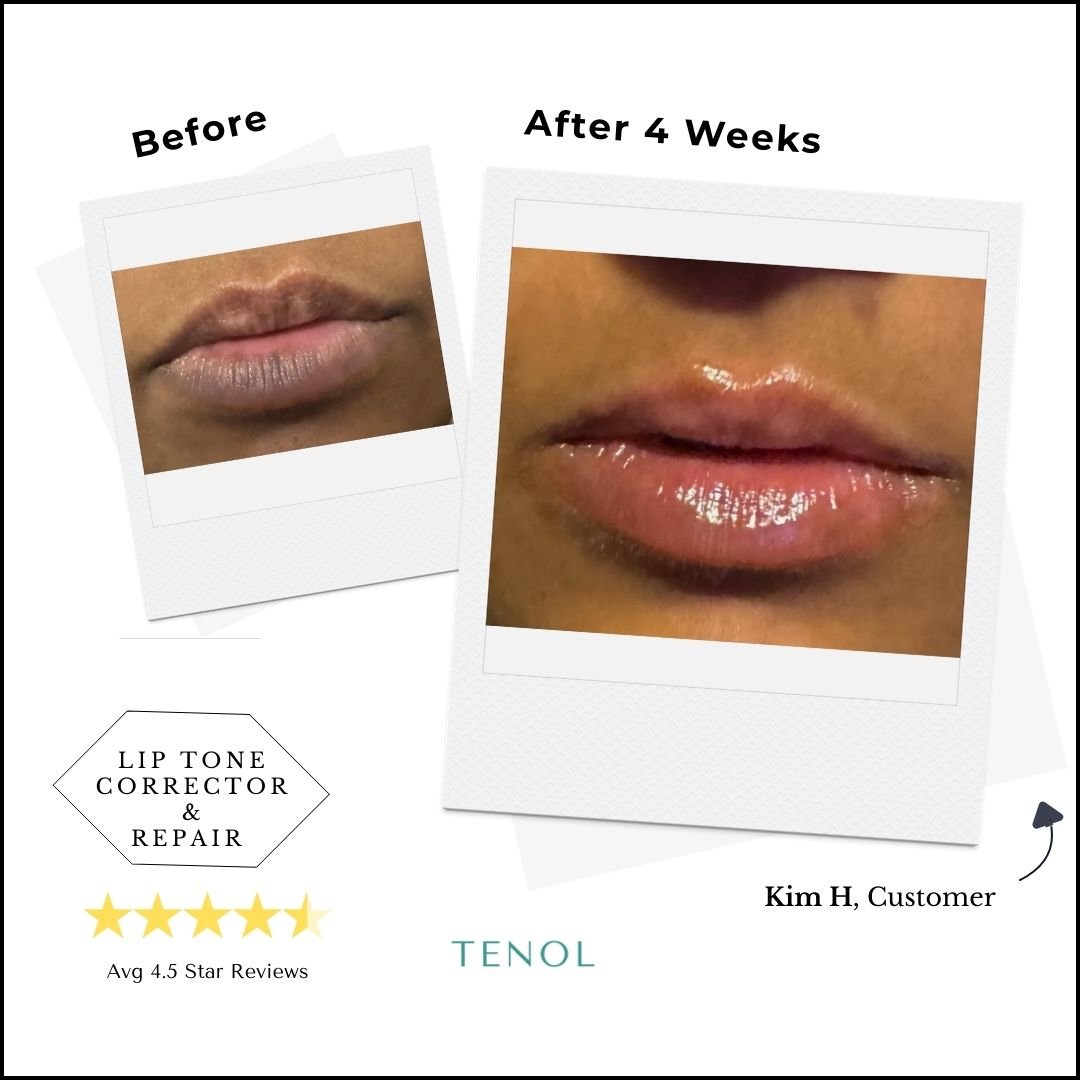 Two - Step Resurfacing & Corrective Lip Renewal System - Tenol™ - Two - Step Lip Treatment
