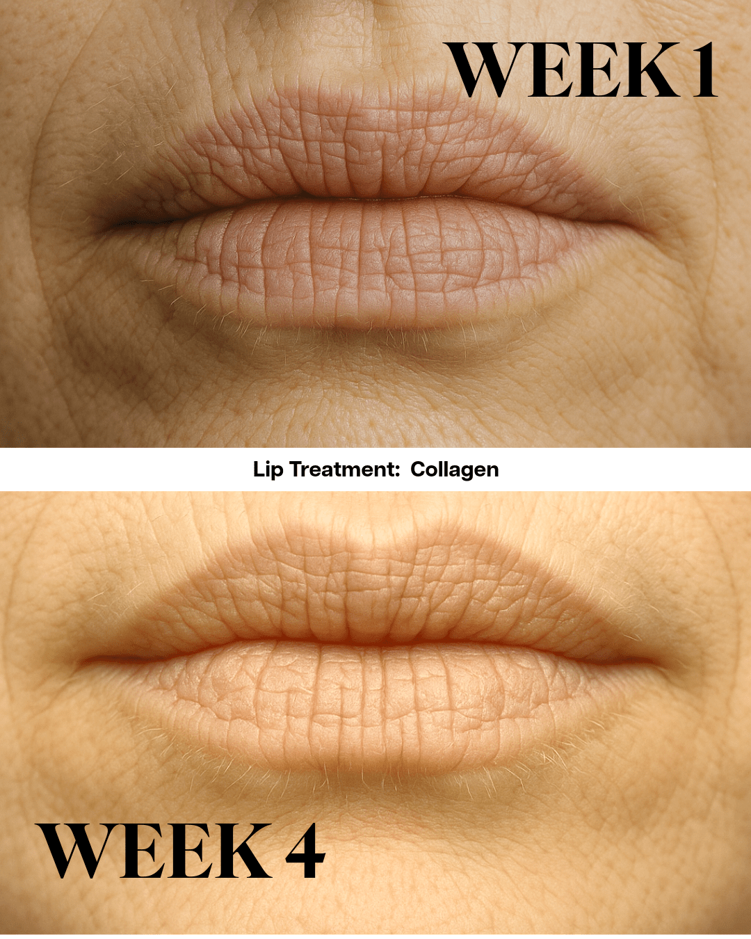Lip Hydration Serum | With Peptides and Ceramides - Tenol™ - Lip Serum